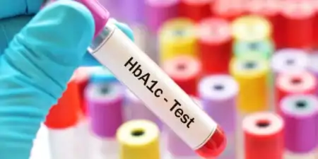 تحليل السكر التراكمي (HbA1c): دليلك لفهم النتائج والمعدل